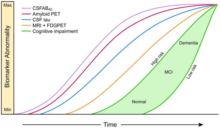 Überarbeitete dynamische Biomarker des pathologischen Kaskadenmodells der Alzheimer-Krankheit - 2012